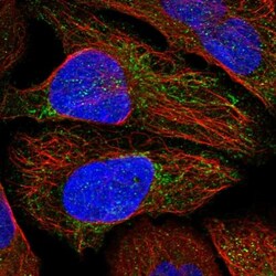 MTERFD2 Antibody, Novus Biologicals 25 &mu;L; Unlabeled:Antibodies, Polyclonal